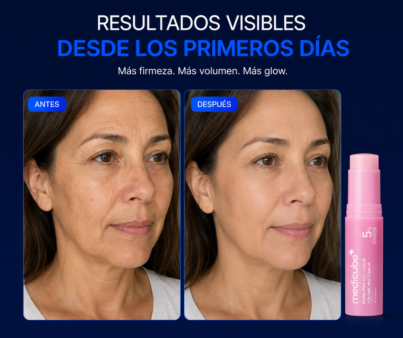 Despídete del aspecto apagado de tu piel